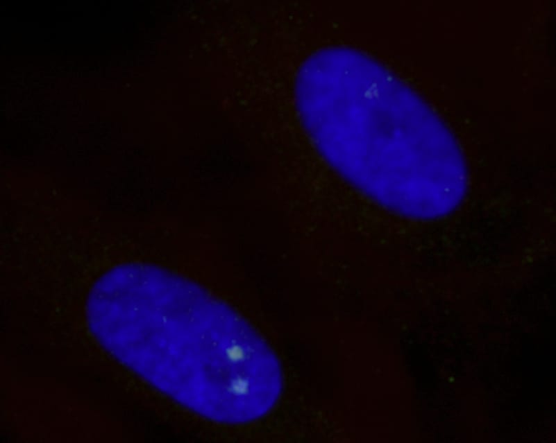 放射線によるDNA損傷を示すバイスタンダー細胞の細胞核（青色）の顕微鏡画像。